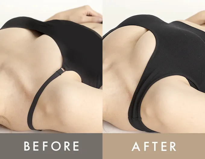 Before／After